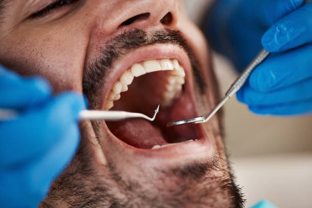 Emergency Cosmetic Dentistry (e.g., broken veneers)